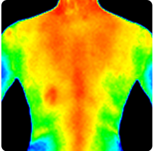 Thermography Early Detection
